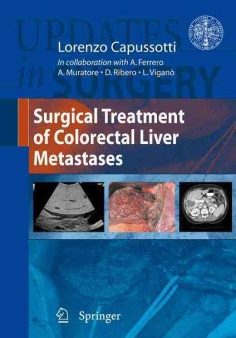 Surgical Treatment of Colorectal Liver Metastases Hot on Sale