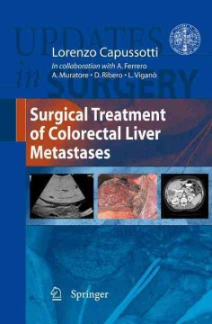 Surgical Treatment of Colorectal Liver Metastases Hot on Sale