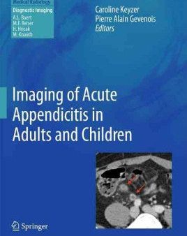 Imaging of Acute Appendicitis in Adults and Children Online now