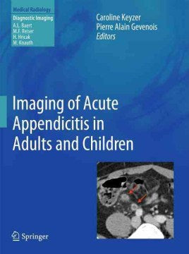 Imaging of Acute Appendicitis in Adults and Children Online now